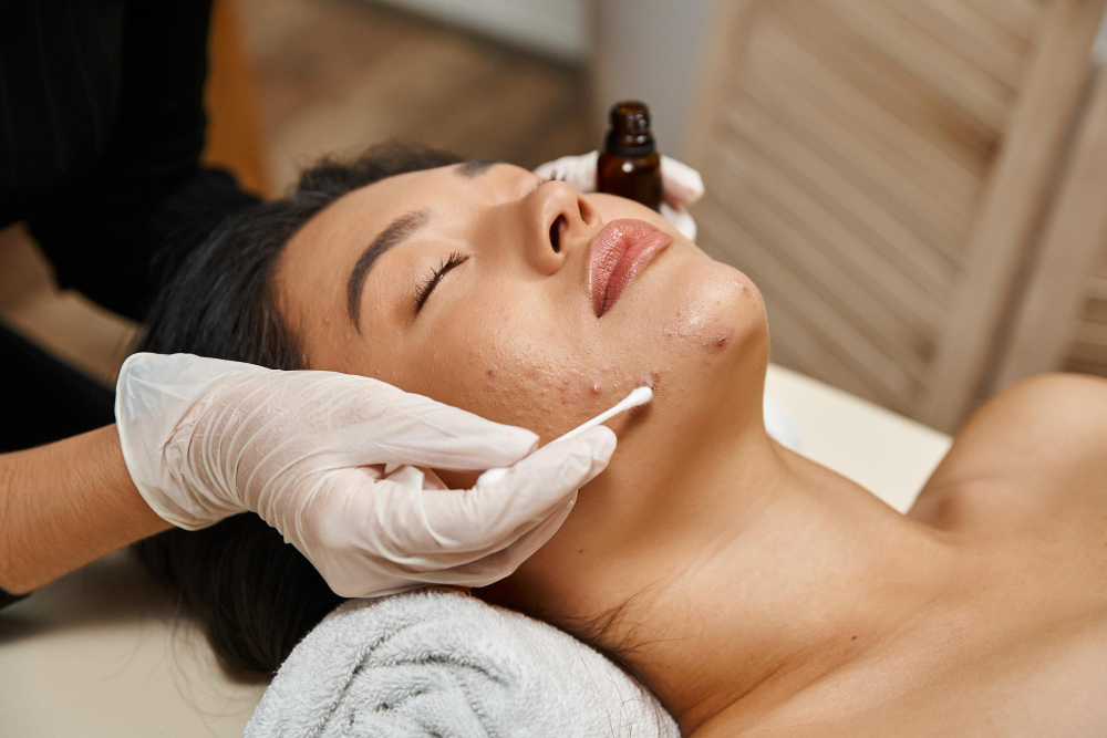 Most Effective Treatment for Acne