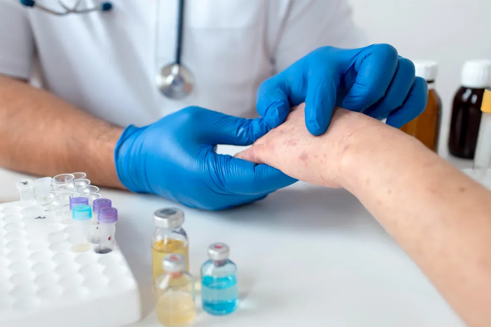 Dermatitis Treatment Kukatpally - Skin Relief